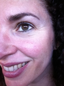 Laura Lawton smile lines round eyes, before Botox